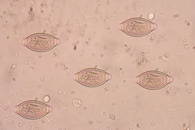 Trichuris, il verme parassita che combatte le infiammazioni